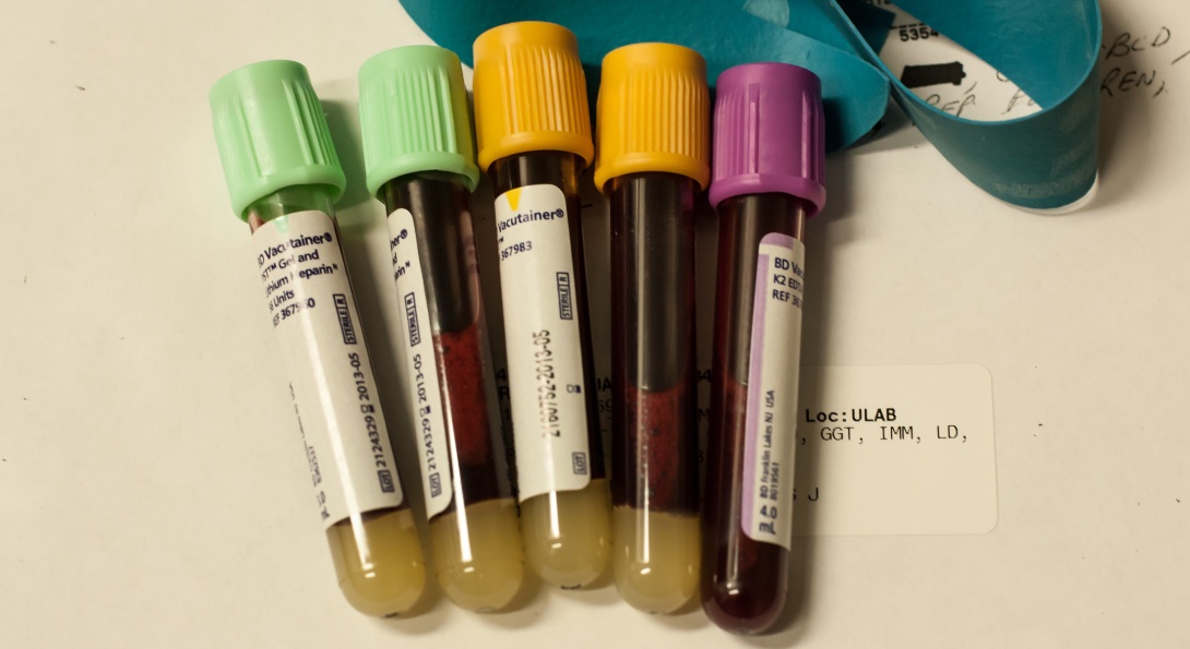 Vials of blood after a patient's blood test.